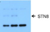 STN8 | Serine/threonine-protein kinase STN8 (chloroplastic) in the group Antibodies Plant/Algal / Photosynthesis / Kinases at Agrisera AB (Antibodies for research) (AS10 1601)